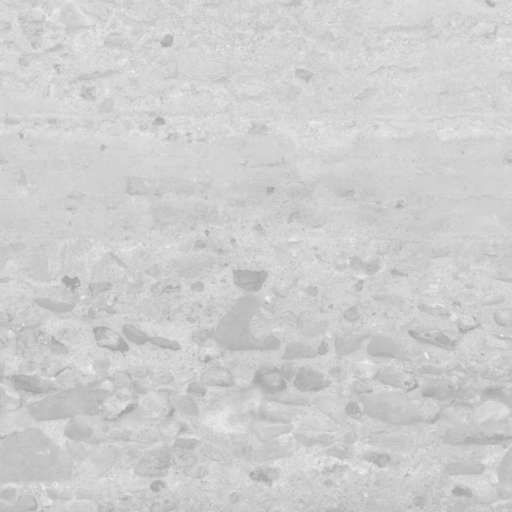 Concrete Wall Old 250x250 Roughness