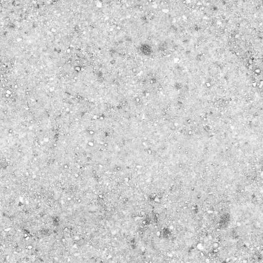Gravel Ground Mossy Mixed A 200x200 Ambient Occlusion