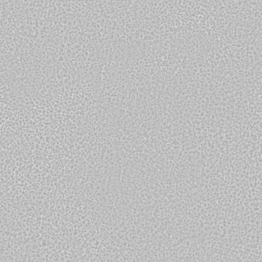 Plaster Wall Pebbles Painted 150x150 Roughness
